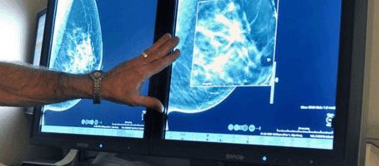 Postgrado en Radiología Mamaria